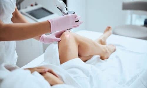 Depilazione Laser